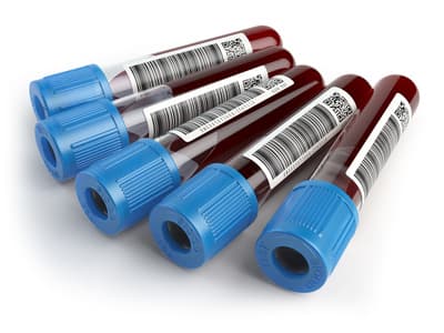 Sample test tubes of blood for veterinary evaluation Sample test tubes of blood for veterinary evaluation